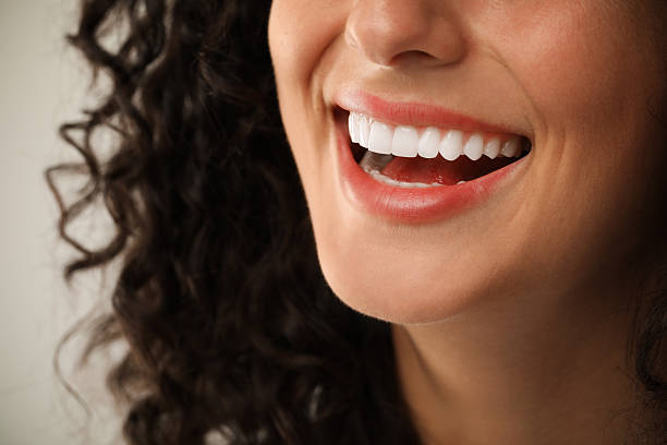 Problems with Veneers: What Johns Island Patients Should Watch Out For