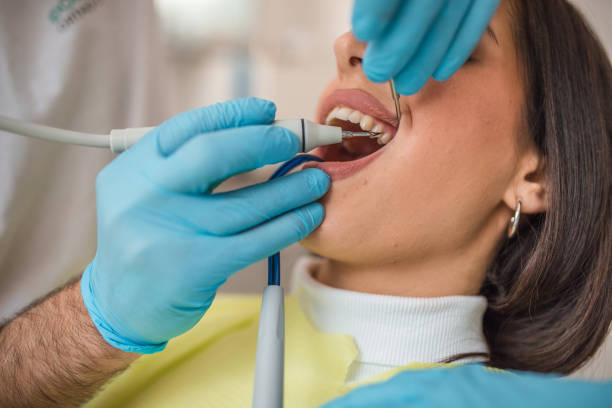 Plaque vs Tartar: What Johns Island Dentists Want You to Know