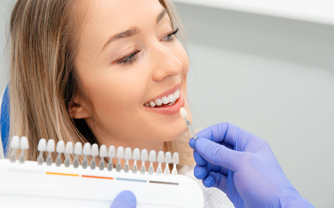 Dental Veneers vs. Crowns in Johns Island: Which Is the Right Choice?
